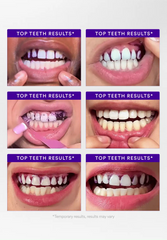 V34 Whitening Strips - Value Deal